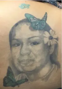 Tattoo Removal Before and After Pictures Boerne, TX