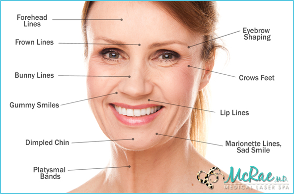 Botox in San Antonio and Boerne, TX